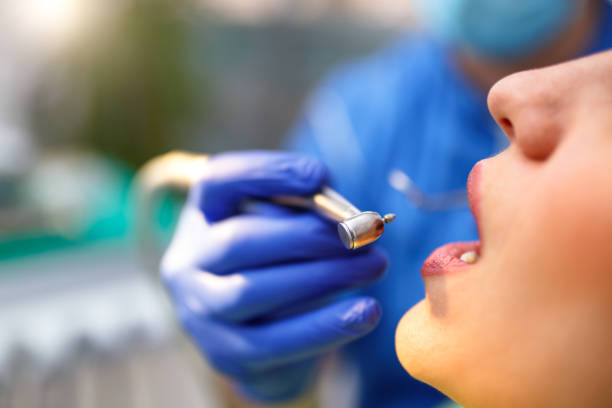 Dental Inlays and Onlays in Riviera Beach, FL